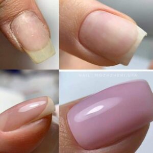 Reposición de Uñas