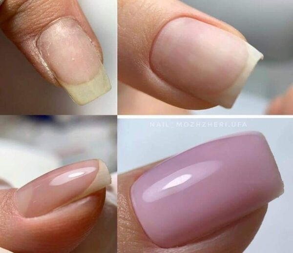 Tratamientos para Uñas